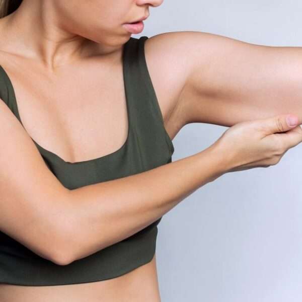 How To Get Rid of Bat Wings: 10 Exercises For Flabby Arms